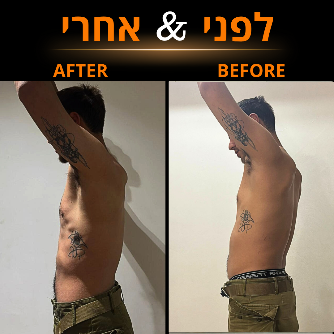 לפני אחרי (37)